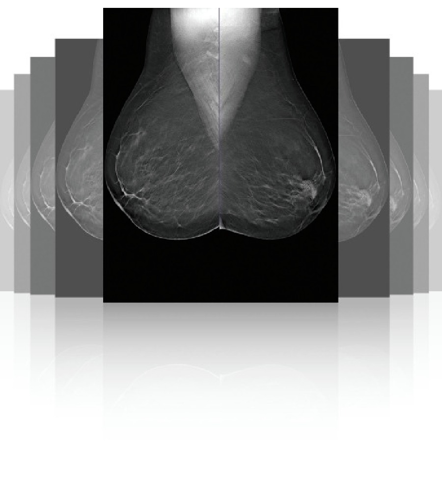 Ψηφιακός Μαστογράφος με Τομοσύνθεση Μαστού (DBT) Clarity™ 3D, Planmed - Image 6