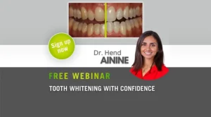 FREE WEBINAR – TOOTH WHITENING WITH CONFIDENCE